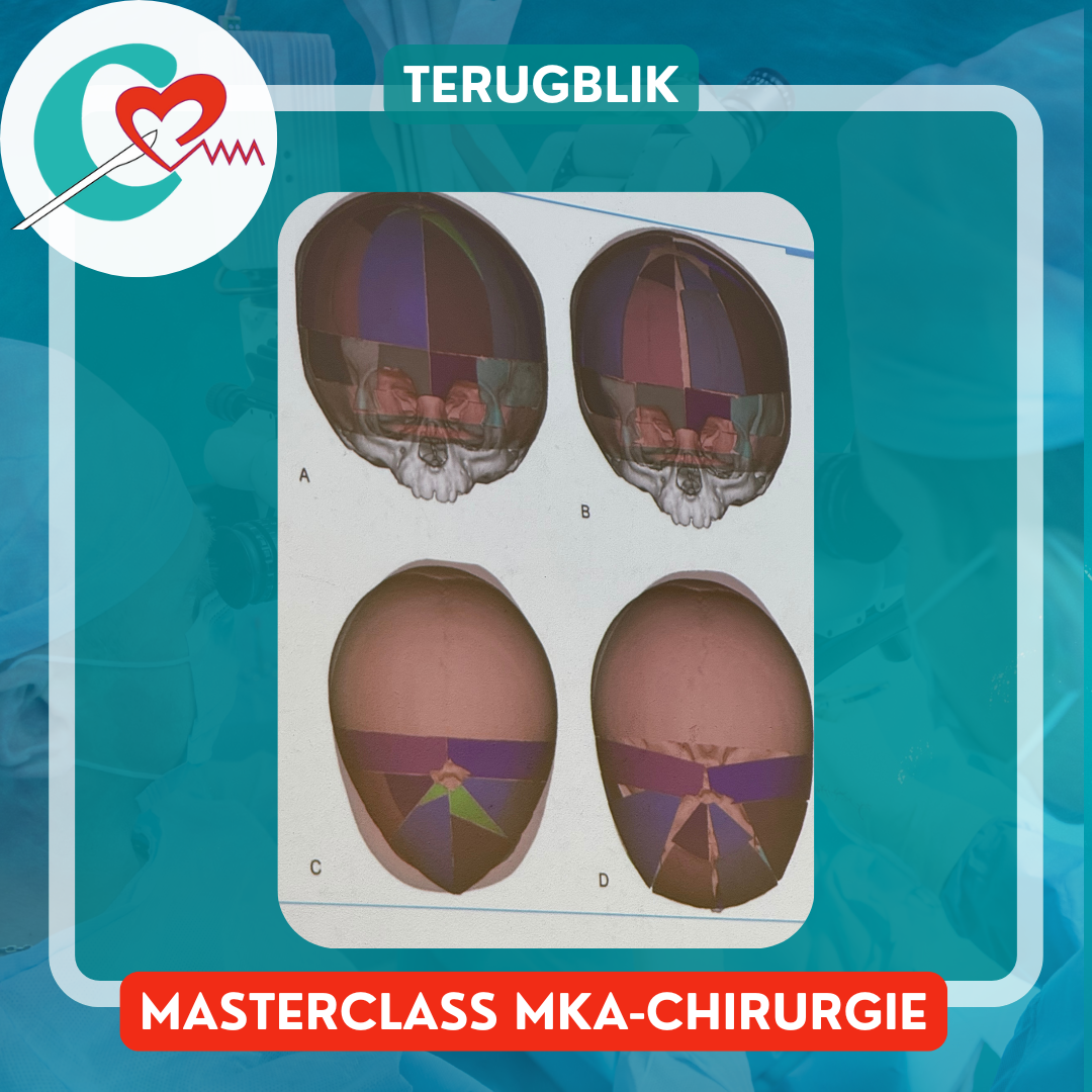 You are currently viewing Terugblik MKA-chirurgie