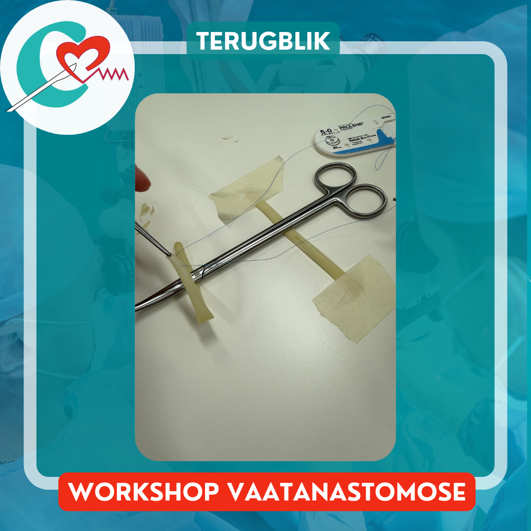 You are currently viewing Terugblik workshop vaatanastomose